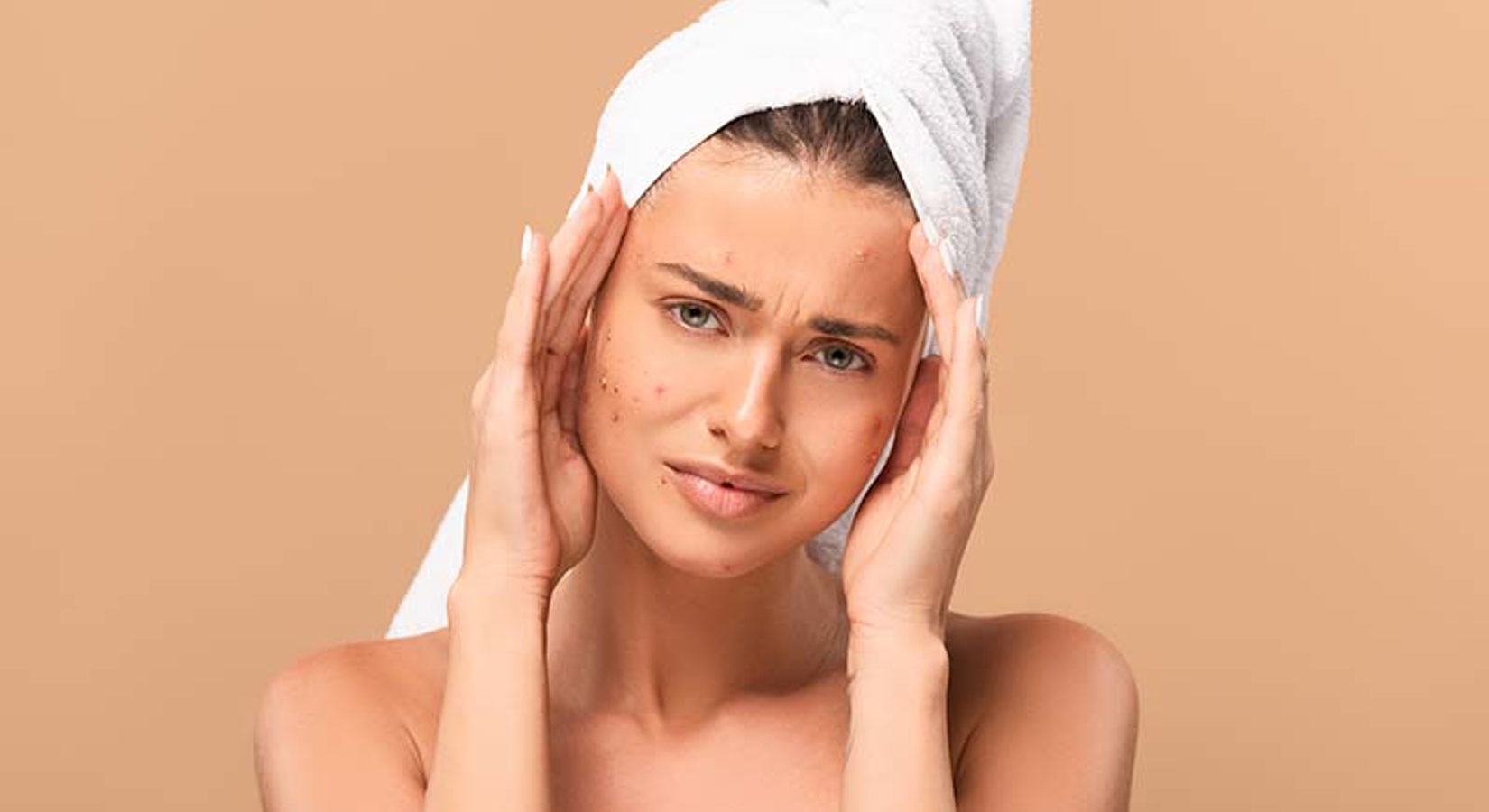 Acne Mentale Impact