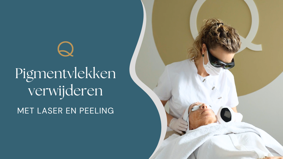 Pigmentvlekken Verwijderen Laser En Peeling (2)