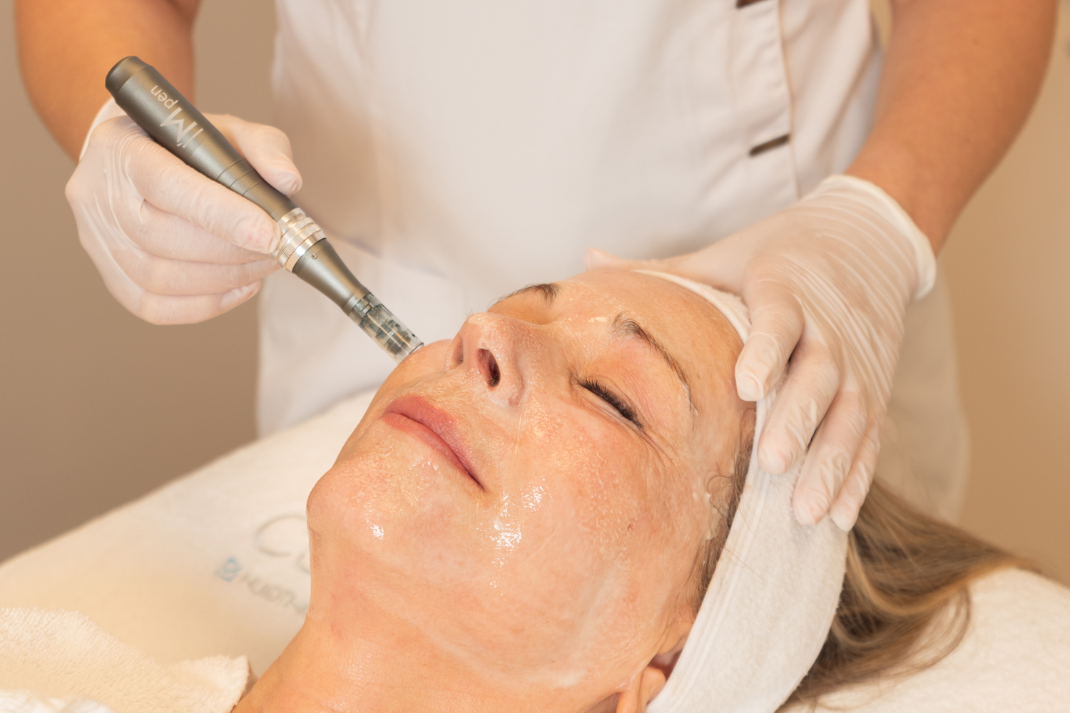 Microneedling Behandeling Bij Cosmetique Totale