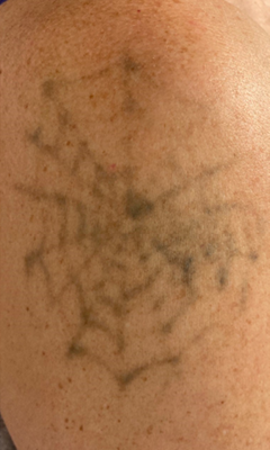 Tattoo 2X 2