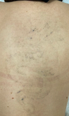 Tattoo 8X2