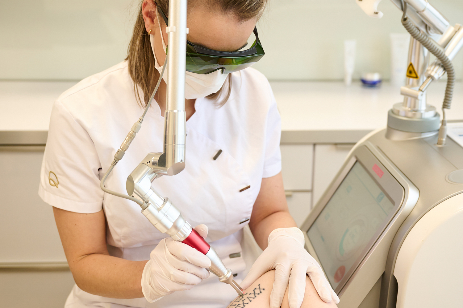 Hoe Lang Duurt Een Behandeling Voor Tatoeage Verwijderen