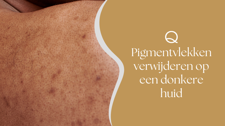 Pigmentvlekken Verwijderen Op Een Donkere Huid
