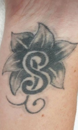 Tattoo laseren voor
