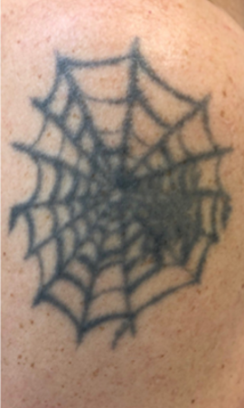 Tattoo 2X