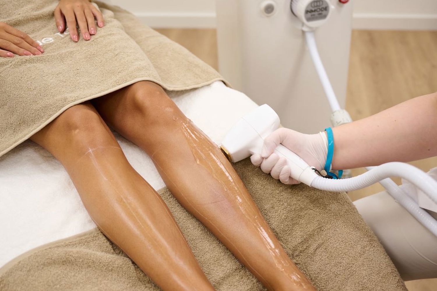 Kan Laserontharing Ook In De Zomer