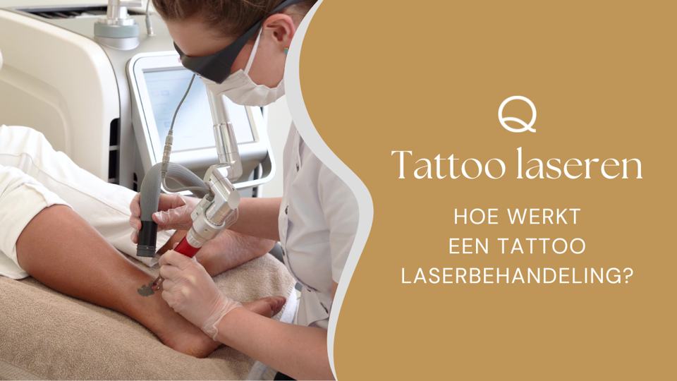Tatoeage Verwijderen Met Picolaser
