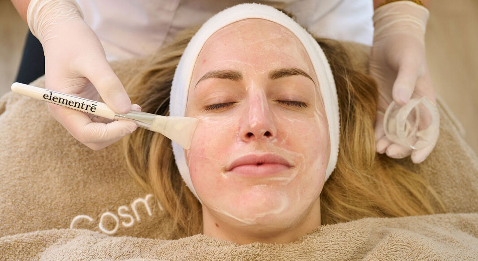 TCA Peeling Egale Huid