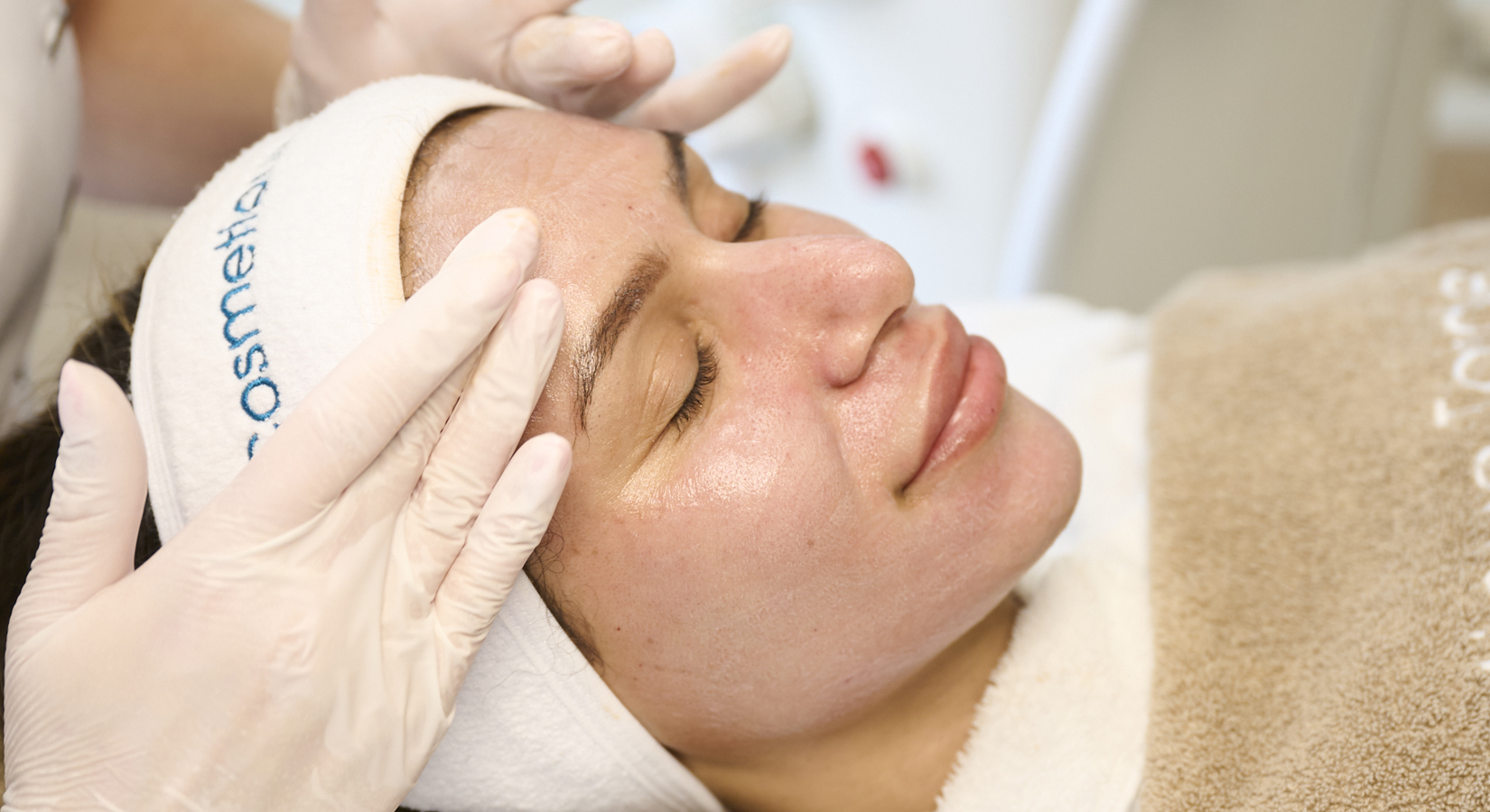 Hormonale Acne Tijdens Je Menstruatiecyclus