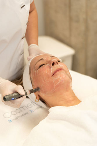 Microneedling Zeist