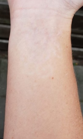 Tattoo Arm Resultaat1na