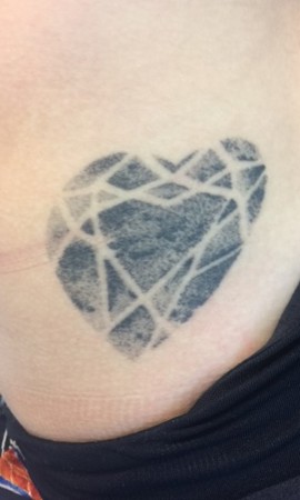 Tatoeage verwijderen resultaat (1)