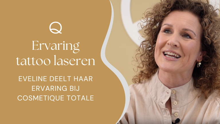 Ervaring Tatoeage Verwijderen Cosmetique Totale (1)