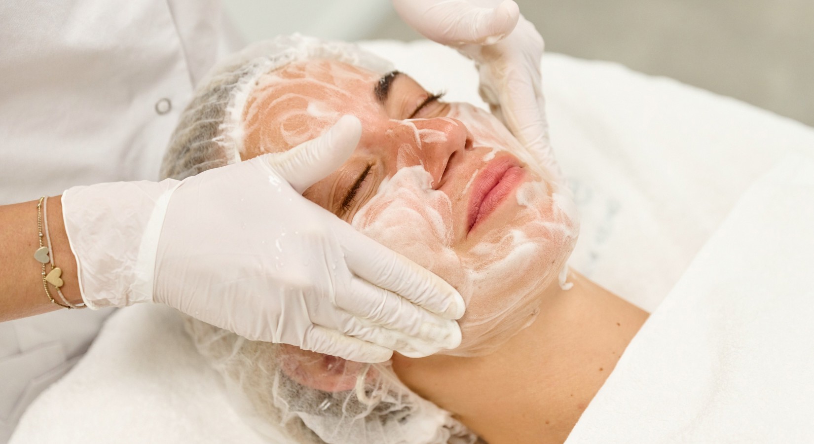 Kosten acne behandelingen
