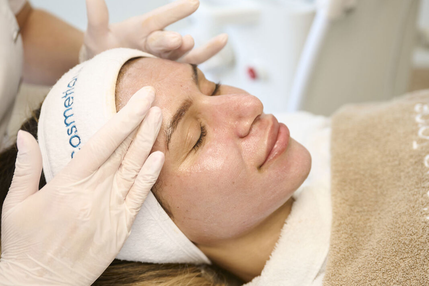 Acne Behandeling (2)
