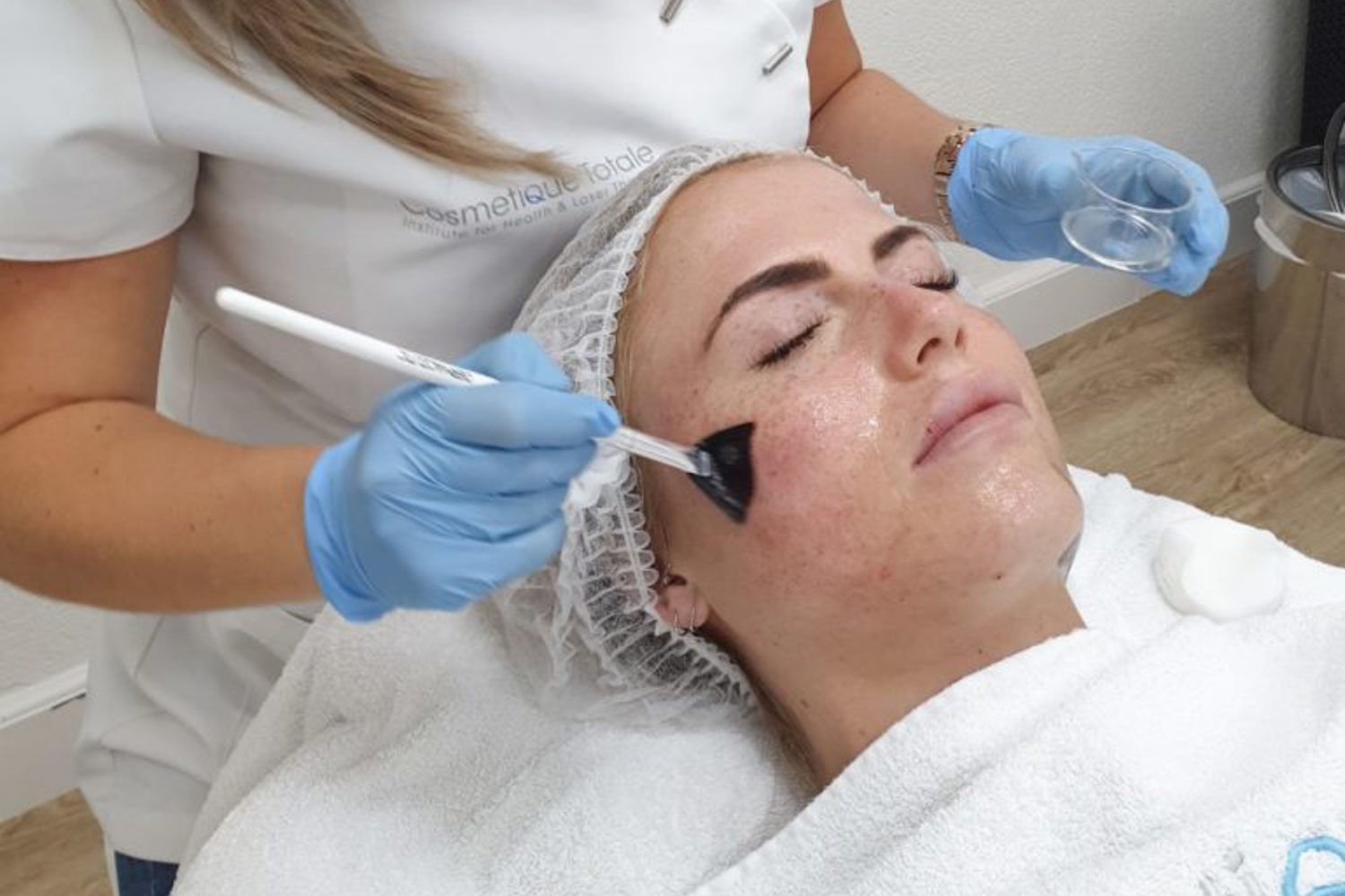 Ervaring Peeling