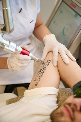 Tattoo Laseren Behandeling