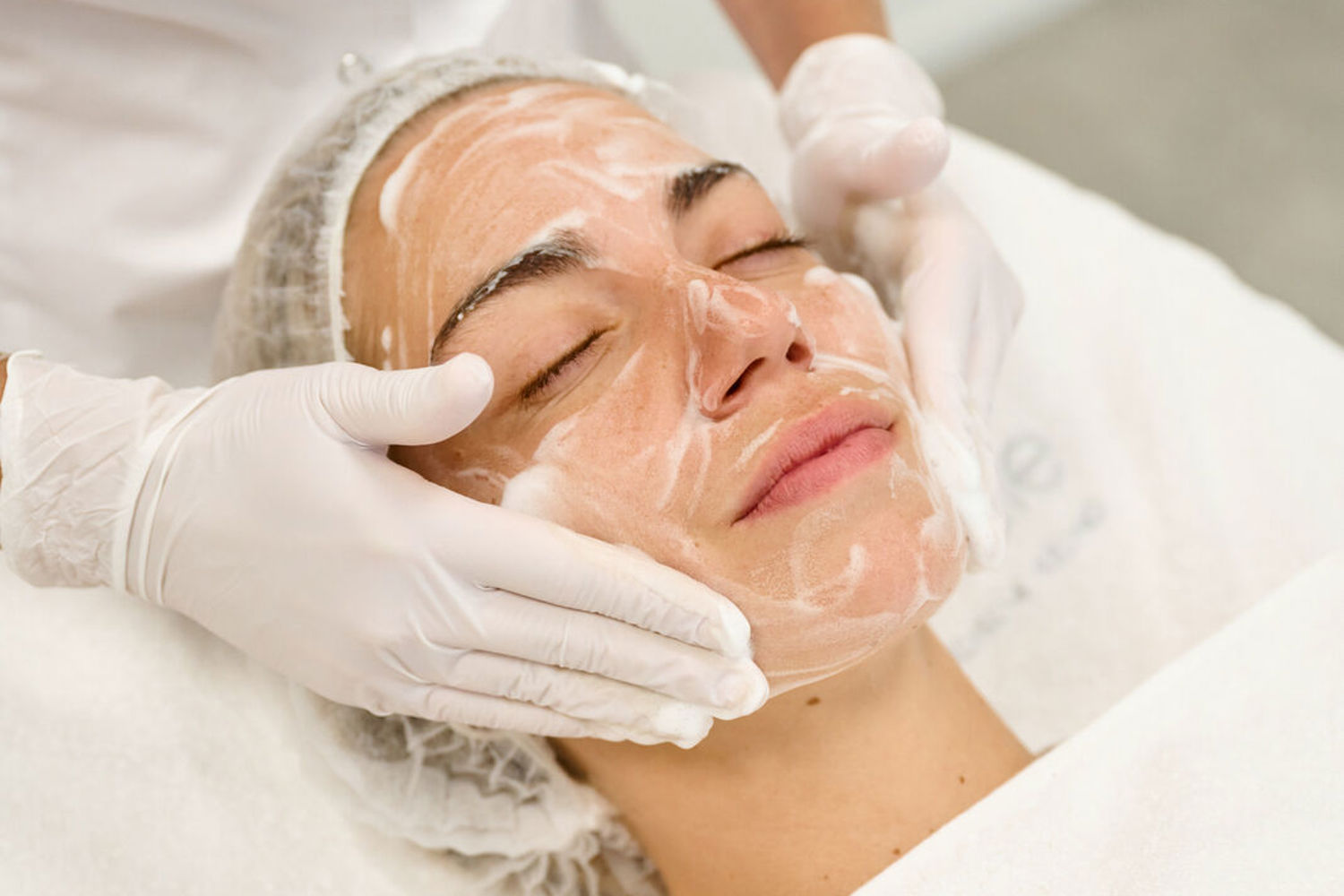 Professionele Rosacea Behandelingen Cosmetique Totale