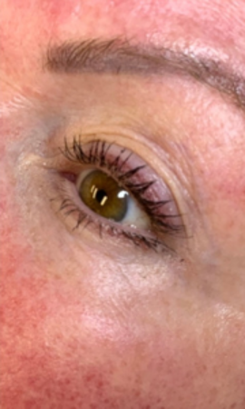 Colorescience Total Eye Treatment Resultaat 2