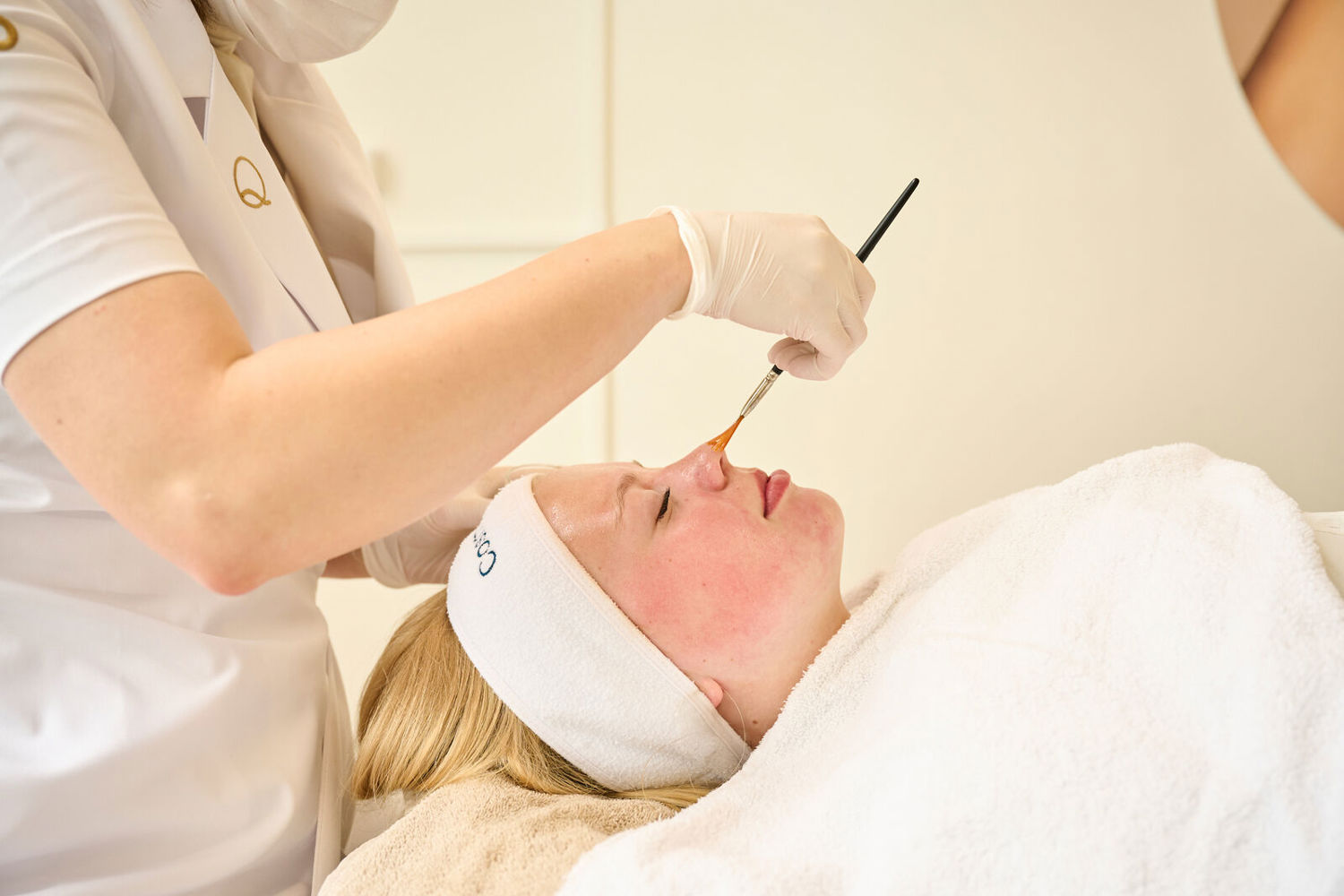 Rosacea Behandeling voor een rustige en egale huid