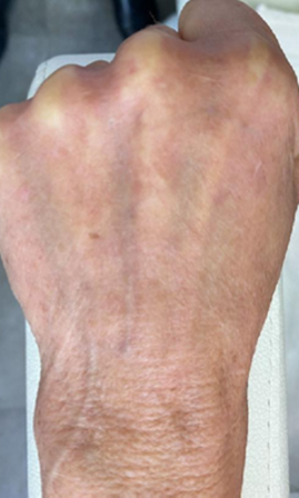 Pigment Hand 1X2