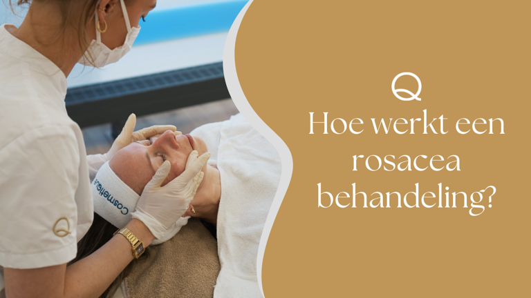 Hoe Werkt Een Rosacea Behandeling