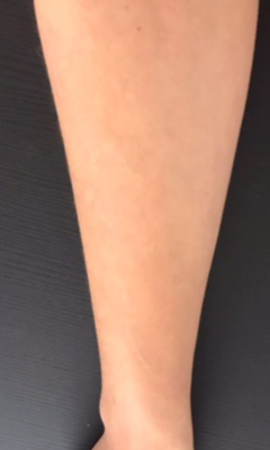 Tattoo 4X12